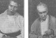 Ensefalit Lethargica