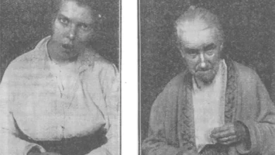 Ensefalit Lethargica